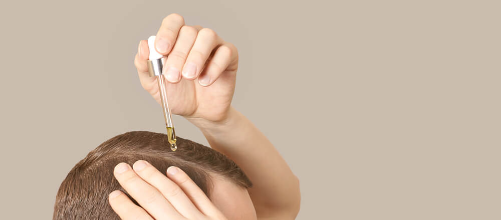 como aplicar o minoxidil no cabelo feminino: orientações